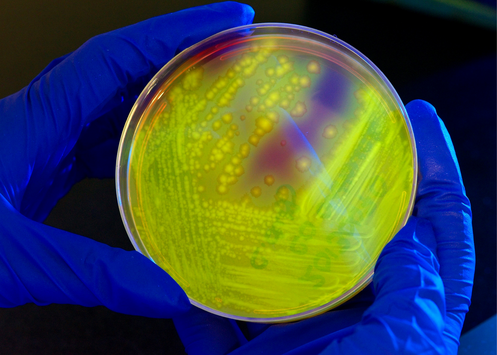 gut health indicator