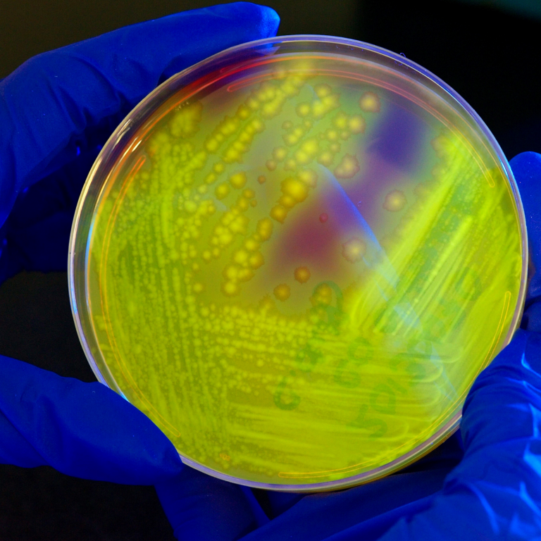 gut health indicator